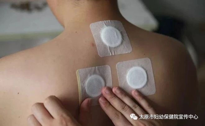 太原市妇幼保健院三伏贴：给身体加把健康火
